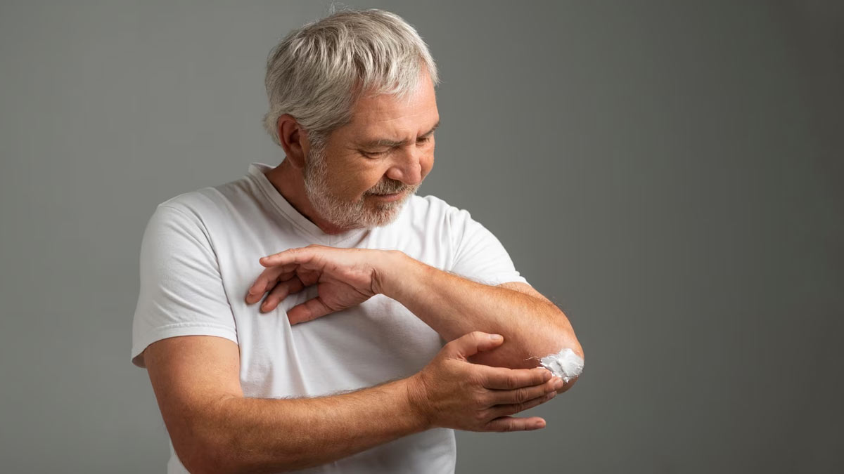 What 50-Year-Olds And Above Should Know About Shingles, Its Painful Symptoms, And Preventive Measures