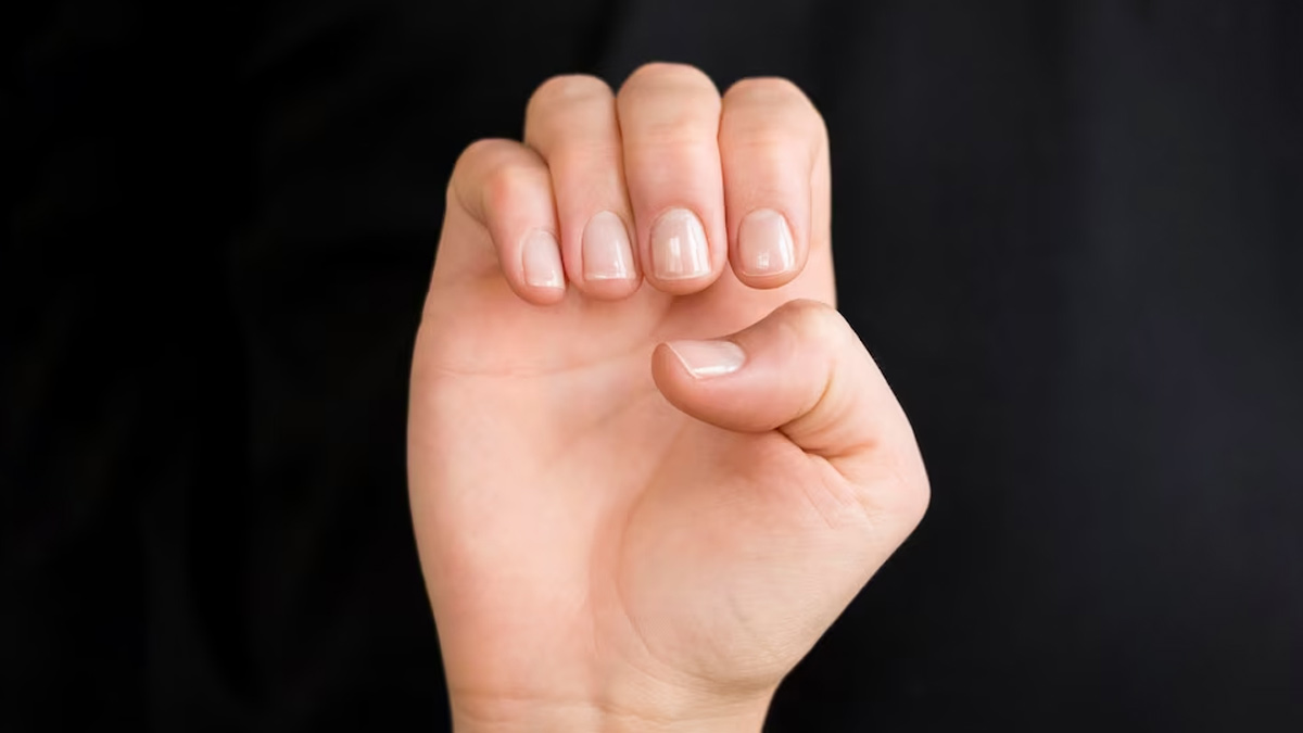 Are Yellow Nails A Big Concern? - Women Fitness Org
