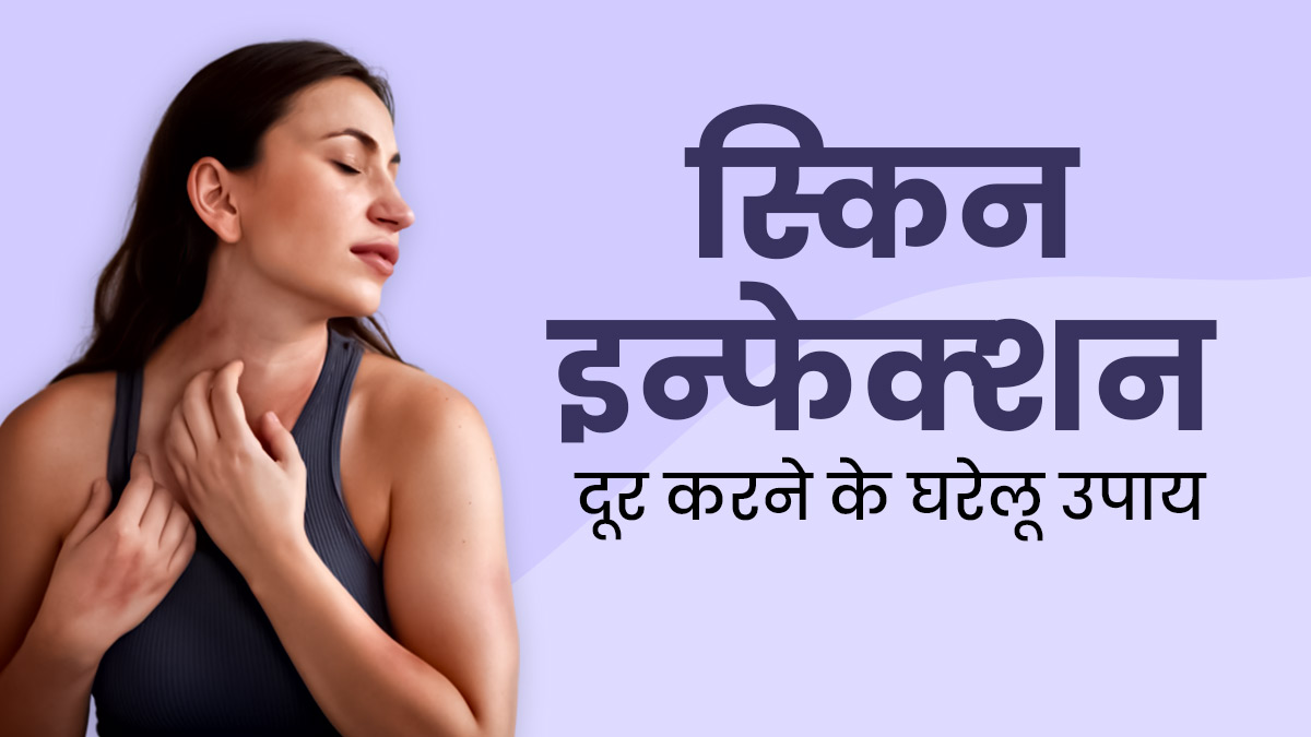 पसीने के कारण त्‍वचा में हो जाए इन्‍फेक्‍शन, तो राहत के ल‍िए अपनाएं ये 5 घरेलू उपाय 