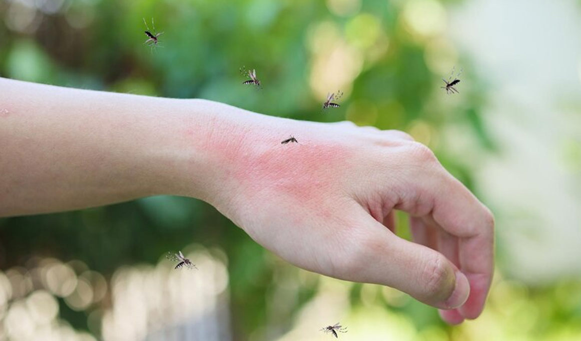 К чему снится что укусил ребенок. Следы от укусов комаров в Бангкоке. Фото москиты кусают человека.