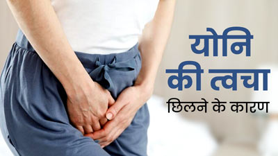 क्या आपकी योनि की त्वचा भी अक्सर छिल जाती है? एक्सपर्ट से समझें इसके कारण