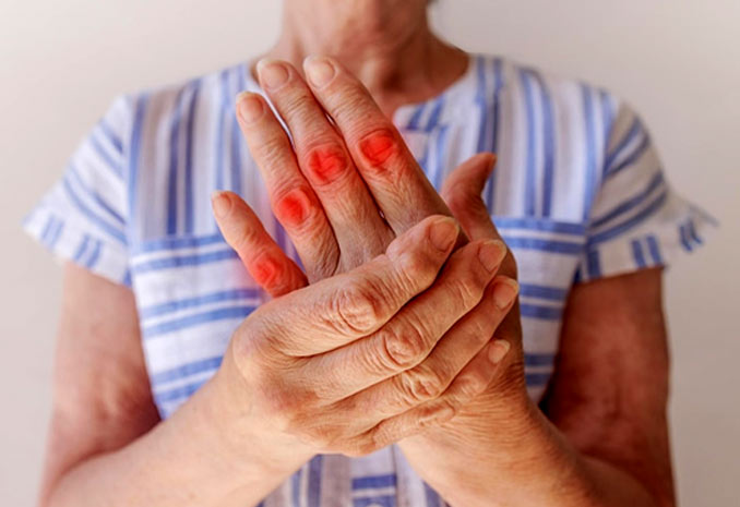 psoratic arthritis in hindi 