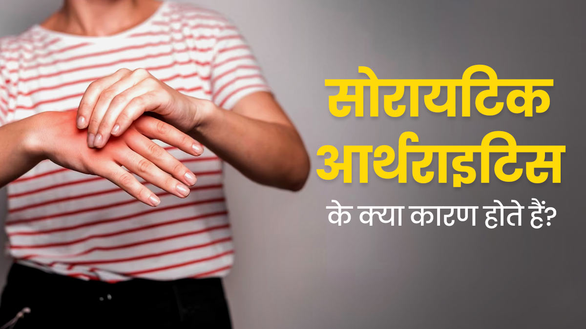 सोरायटिक अर्थराइटिस के क्या कारण होते हैं? इसे समझें आसान भाषा में 