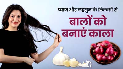 सफेद बालों को काला बनाने के लिए इस तरह करें प्याज और लहसुन के छिलकों का इस्तेमाल, जानें उपयोग का सही तरीका