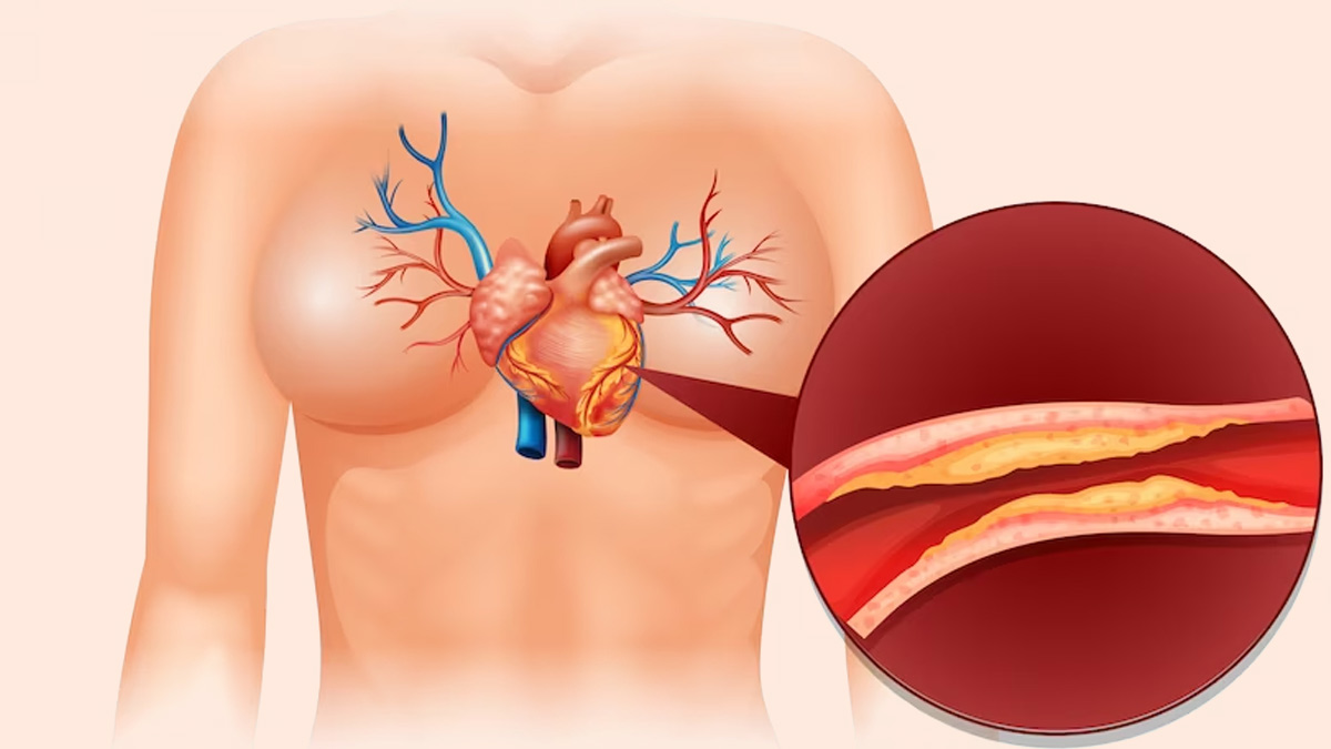 Teas for Reducing Cholesterol in Hindi: