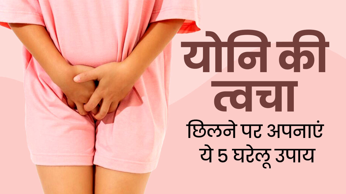 योनि की त्वचा छिलने पर अपनाएं ये 5 घरेलू उपाय, खुजली और इरिटेशन से मिलेगी राहत 
