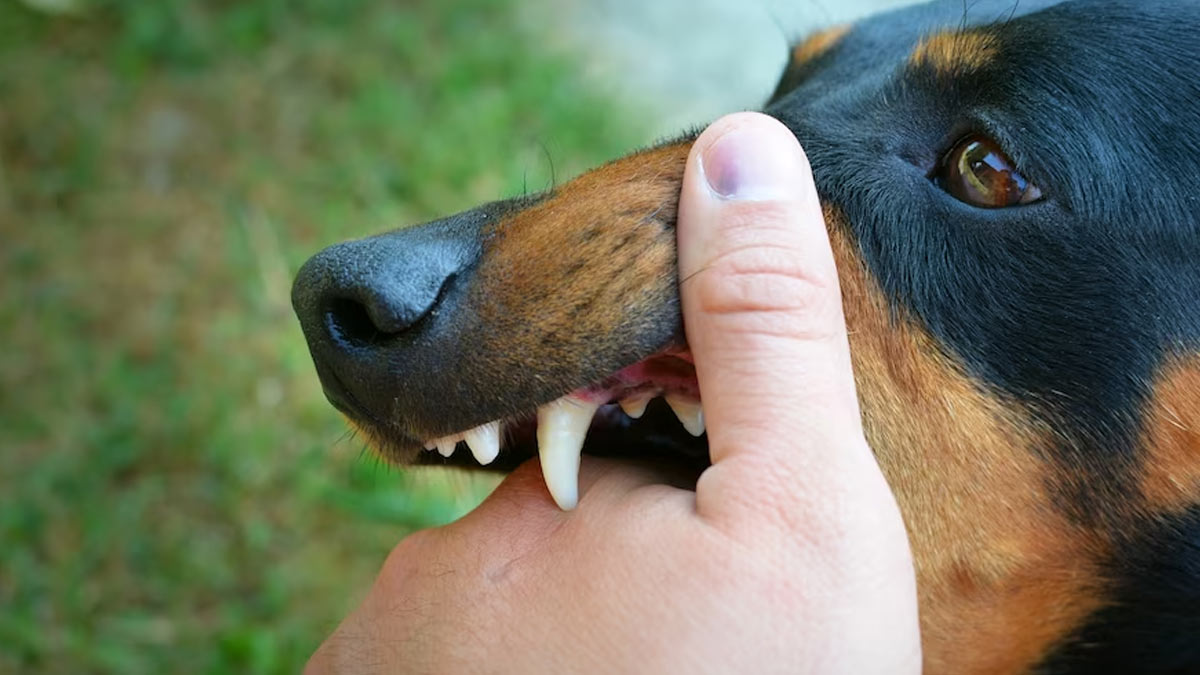 Rabies in Human