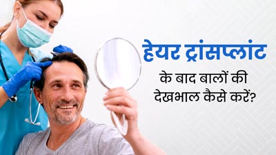 हेयर ट्रांसप्लांट के बाद बालों की देखभाल कैसे करें? जानें क्या करें और क्या नहीं