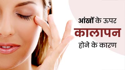 आंखों के ऊपर कालापन क्यों होने लगता है? एक्सपर्ट से समझें इसका कारण 