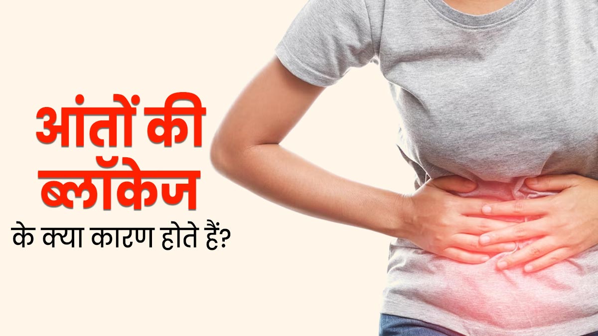 आंतों की ब्लॉकेज (Bowel Obstruction) के क्या कारण होते हैं? जानें बचाव के उपाय