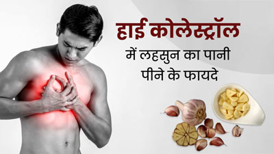 हाई कोलेस्ट्रॉल से छुटकारा पाने के लिए ऐसे करें लहसुन के पानी का सेवन, मिलेगा फायदा