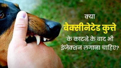 क्या वैक्सीनेटेड कुत्ते के काटने के बाद भी इंजेक्शन लगाना चाहिए? जानें क्या कहते हैं डॉक्टर