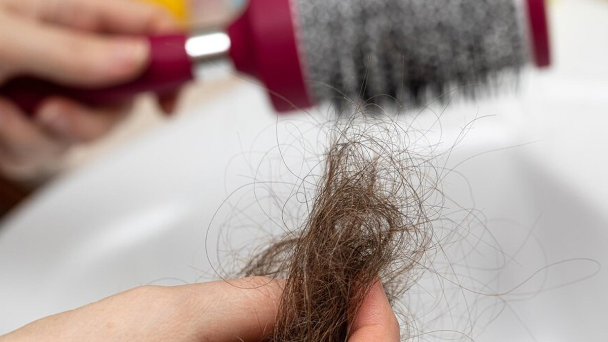 Alopecia Warning Signs