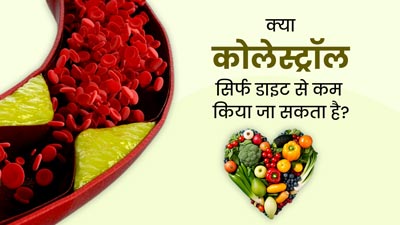 क्या कोलेस्ट्रॉल को बिना दवा, सिर्फ डाइट के सहारे कम किया जा सकता है? जानें डॉक्टर की राय