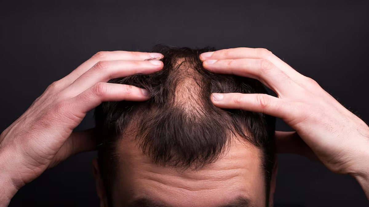 Alopecia patient calls for bald emoji to help represent hair loss - BBC News