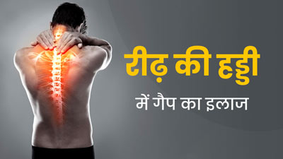 रीढ़ की हड्डी में गैप क्यों होता है? डॉक्टर से जानें कारण और इलाज