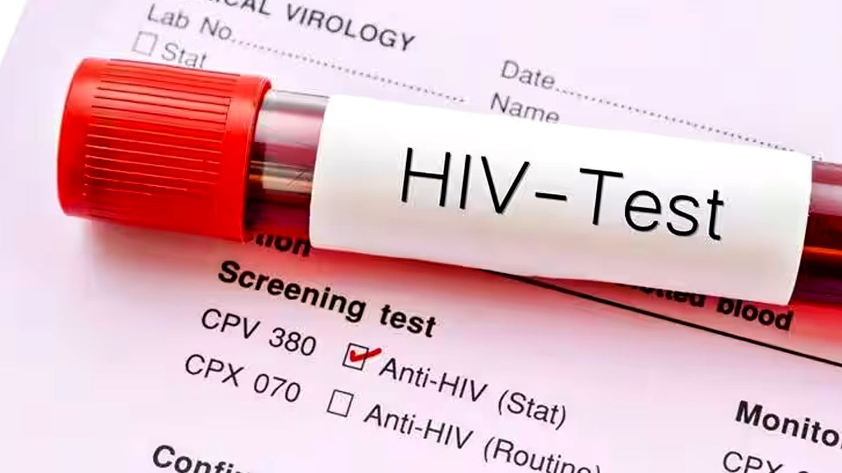 महाराष्ट्र में तेजी से बढ़े HIV के मामले, सालभर में इतने लोग हुए संक्रमित
