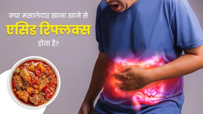 क्या वाकई मसालेदार खाना खाने से एसिड रिफ्लक्स होता है? जानें डॉक्टर से