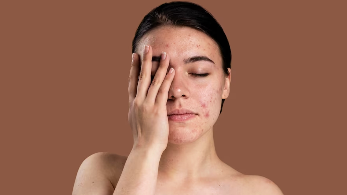 Unmasking Psoriasis Here Are 6 Warning Signs You Should Know