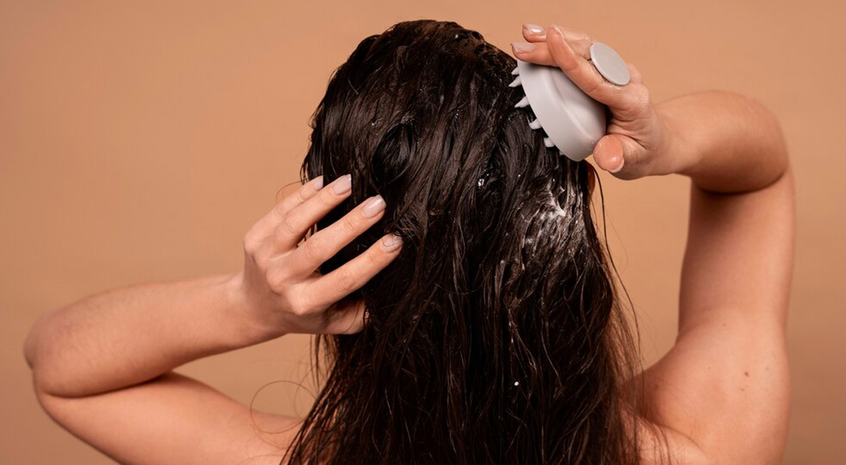 dandruff