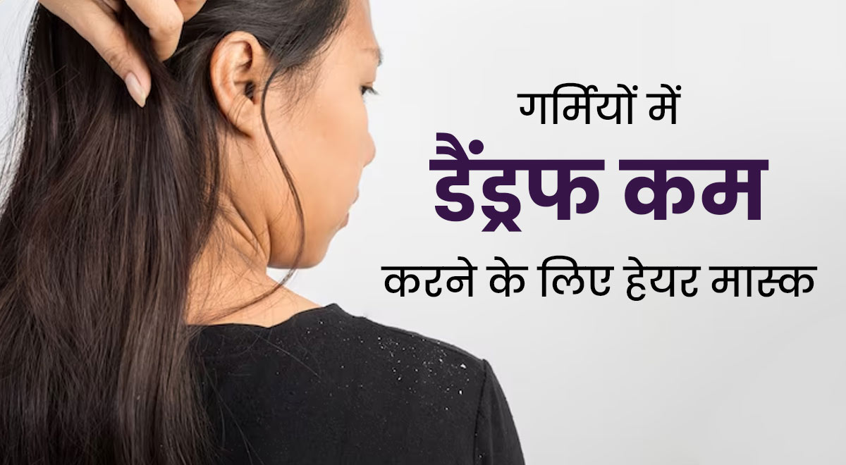 गर्मियों में डैंड्रफ कम करने के लिए लगाएं ये 3 हेयर मास्क, खुजली से भी मिलेगी राहत 