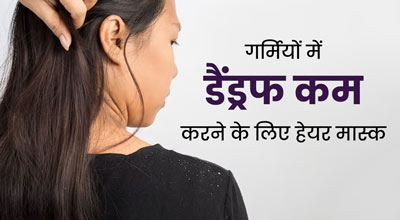 गर्मियों में डैंड्रफ कम करने के लिए लगाएं ये 3 हेयर मास्क, खुजली से भी मिलेगी राहत 