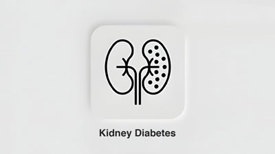 Diabetes May Cause Kidney Disease: Expert Explains Their Connection And Lists Lifestyle Tips