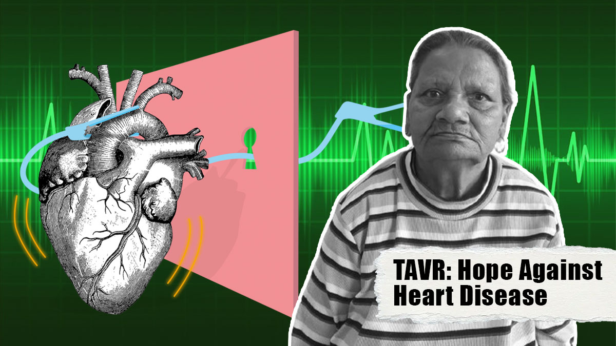 TAVR Offers Hope Against Heart Disease In Elderly, Says Expert: Exploring 72 Years Old Heera Mishra’s Case