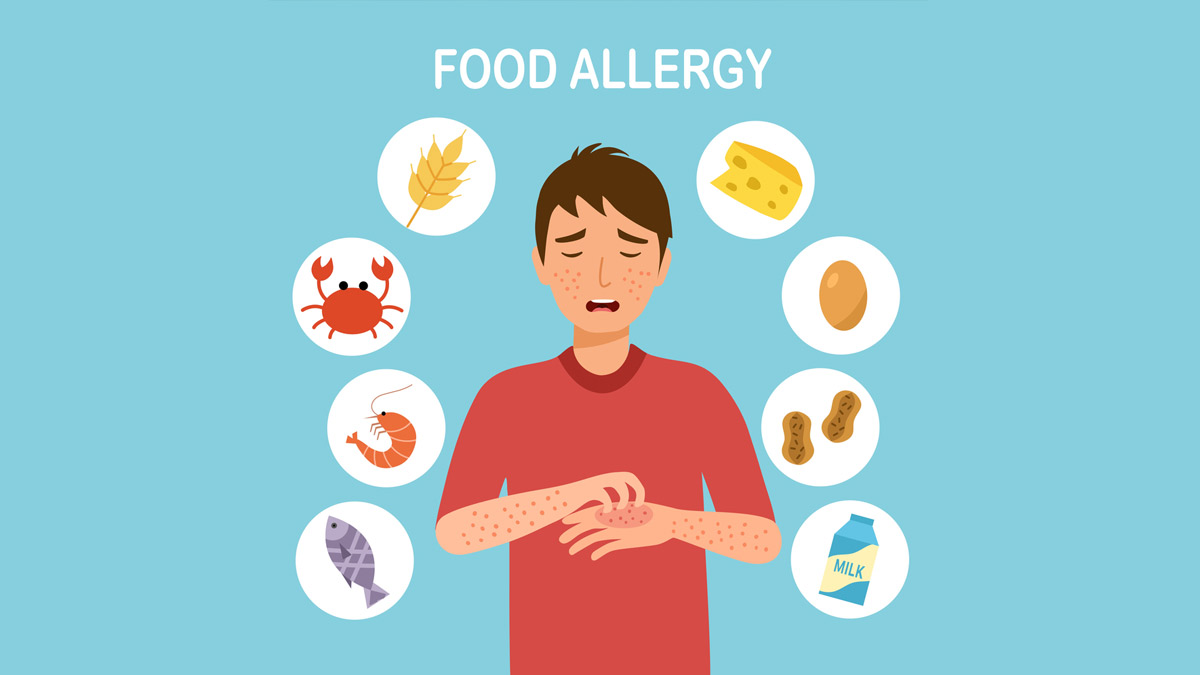 Dealing With Food Allergies? Expert Lists Management And Preventive ...