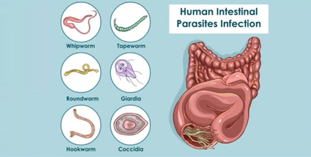 Ayurvedic Home Remedies for Stomach Worms: 7 Natural Solutions for ...