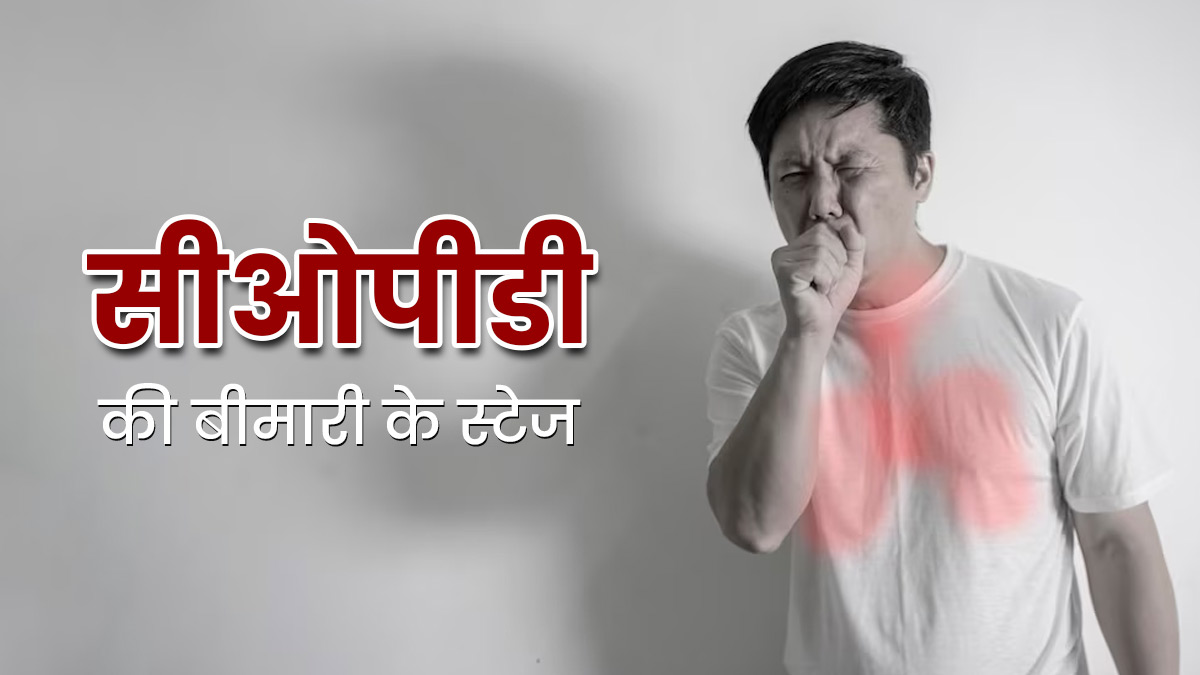 सीओपीडी की बीमारी के होते हैं ये 4 स्टेज, जानें लक्षण और बचाव