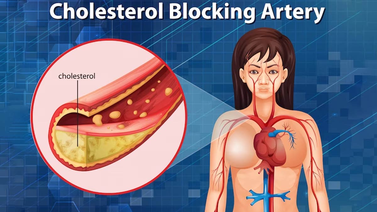 Want To Curb High Cholesterol? Start Eating These Carbohydrates