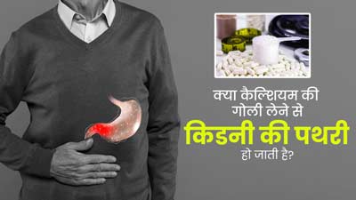 क्या कैल्शियम की गोली खाने से वाकई किडनी की पथरी हो जाती है? डॉक्टर से जानें सच्चाई