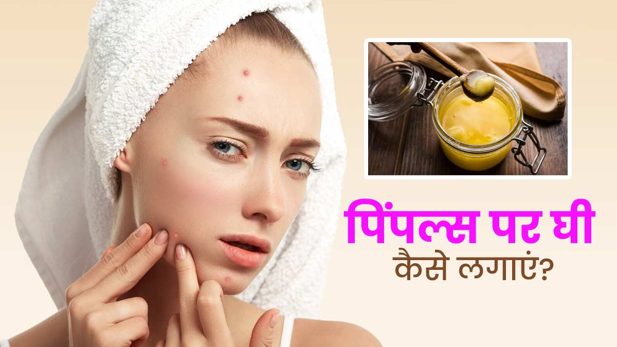 मुंहासों की समस्या दूर करेगा घी, जानें इसे चेहरे पर लगाने के फायदे और तरीका