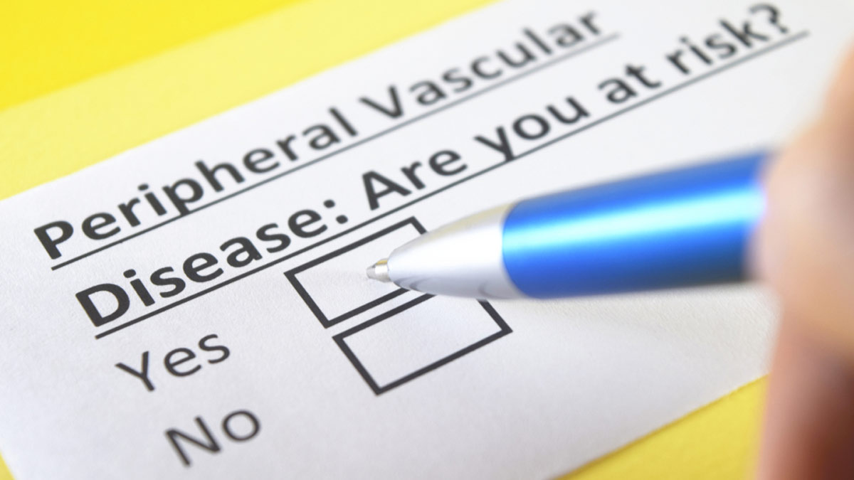 Peripheral Vascular Disease: Expert Explains Its Symptoms, Causes, Diagnosis, And Treatment