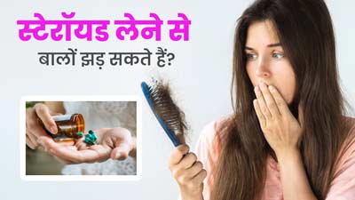 क्या स्टेरॉयड लेने से हेयर फॉल की समस्या होती है? एक्सपर्ट से जानें बचाव के उपाय