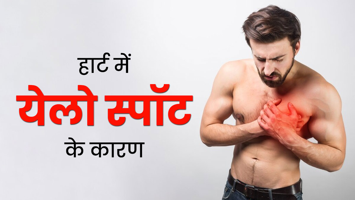 मुख्तार अंसारी की ऑटोप्सी रिपोर्ट में हार्ट पर दिखा येलो स्पॉट, जानें इसके बारे में