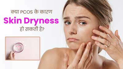 क्या पीसीओएस के कारण स्किन में ड्राईनेस हो सकती है? एक्सपर्ट से जानें सच्चाई