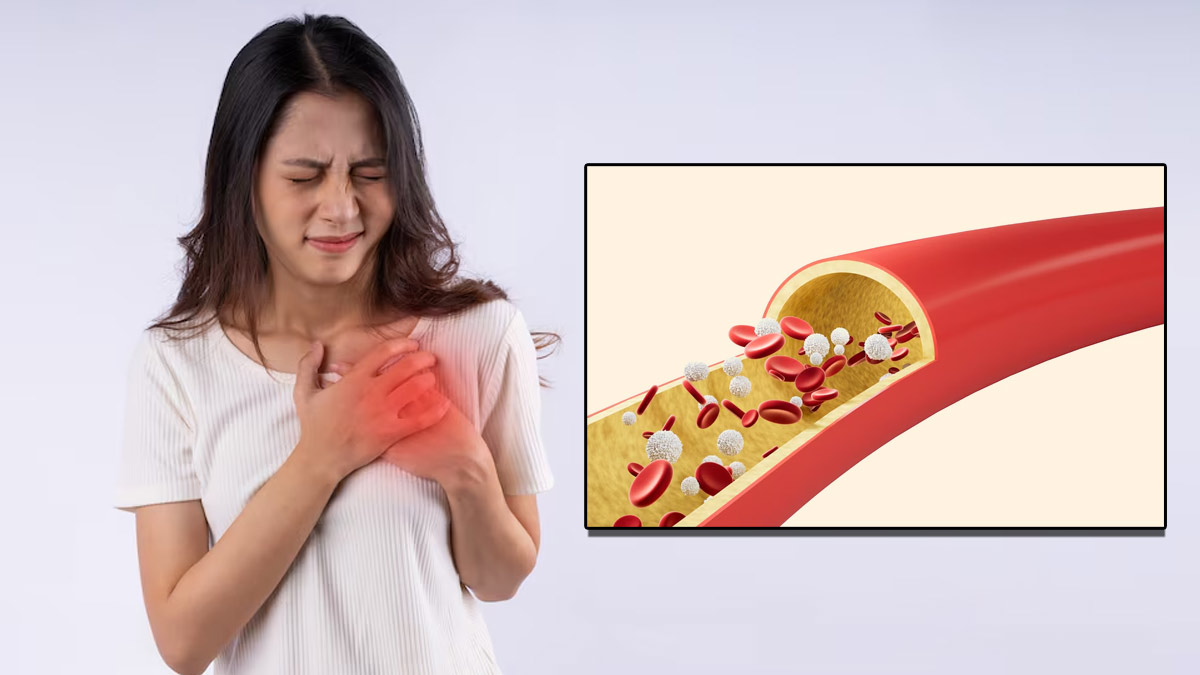 High Cholesterol: सुबह उठते ही शरीर में दिखाई दे ये लक्षण, तो समझ जाएं बढ़ा हुआ है आपका कोलेस्ट्रॉल