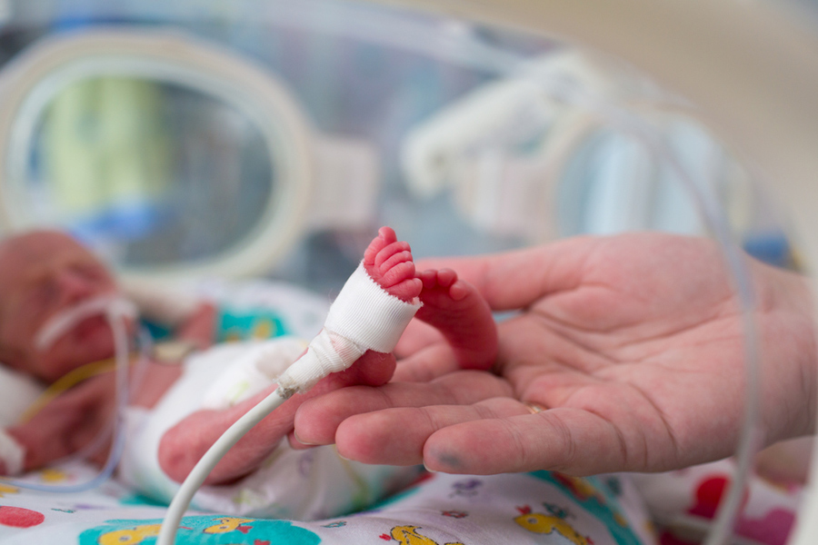 premature-birth