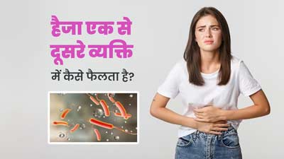 Cholera: हैजा एक से दूसरे व्यक्ति में कैसे फैलता है? डॉक्टर से जानें