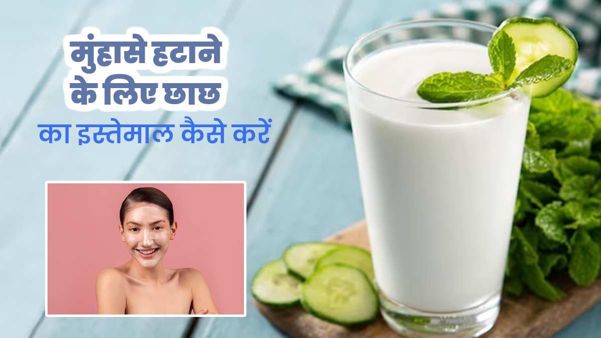 छाछ से मिटाएं चेहरे पर मौजूद मुंहासों के निशान, एक्सपर्ट से जानिए तरीका