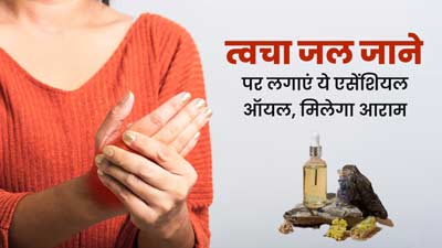 त्वचा जल गई है तो इस्तेमाल करें ये 3 एसेंशियल ऑयल, जलन से भी मिलेगी राहत  