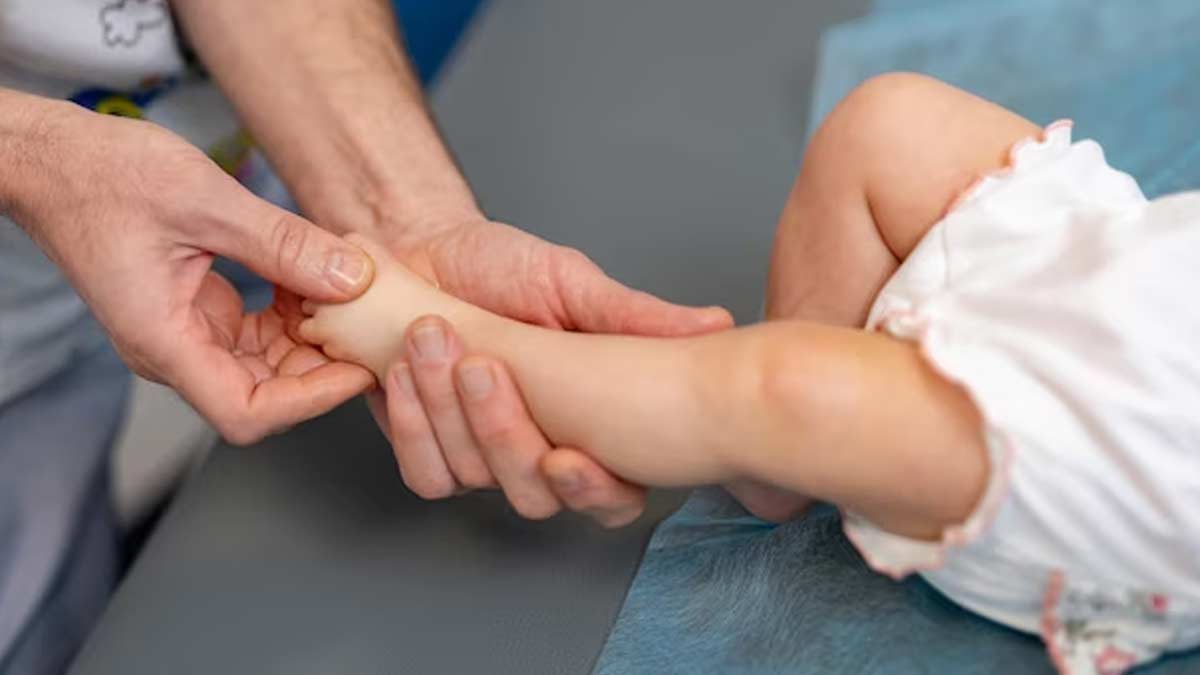 rickets in child in hindi 
