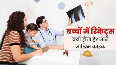 Rickets Disease: बच्चे में ये 5 लक्षण नजर आए तो न करें नजरअंदाज, रिकेट्स रोग का होते हैं संकेत