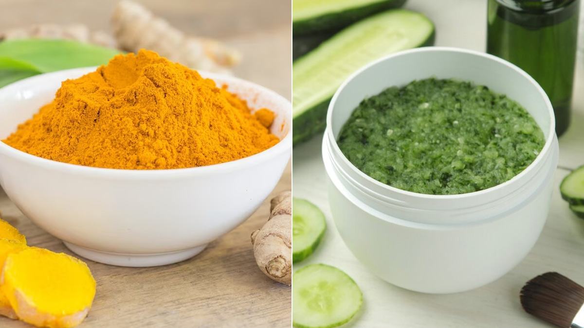 face pack for acne 