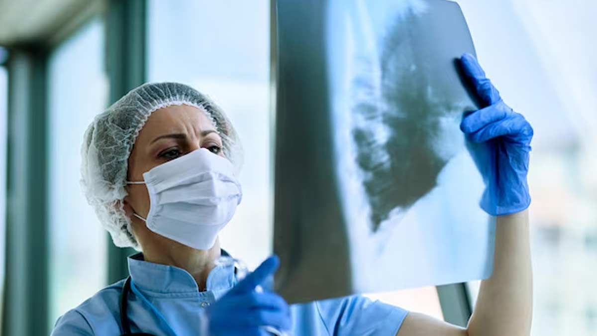 can tb occurs without cough