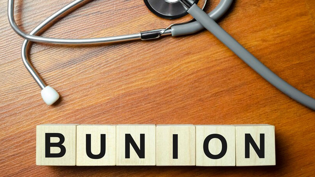 bunions