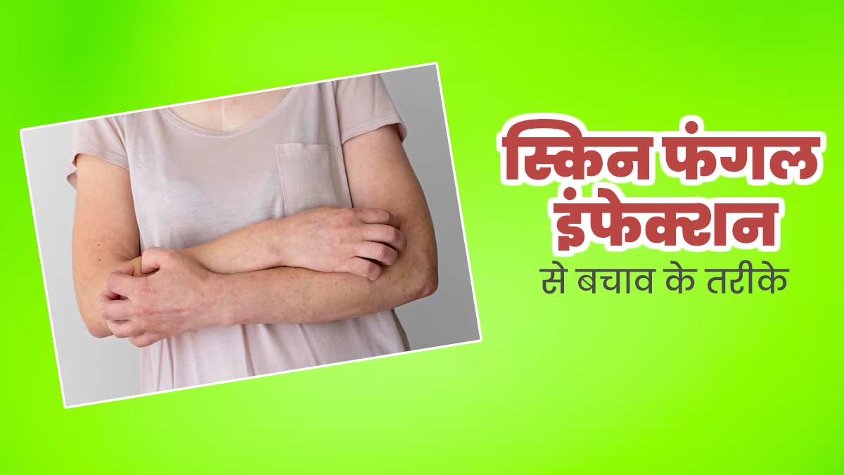 गर्मियों में बढ़ जाता है त्वचा पर फंगल इंफेक्शन का खतरा, एक्सपर्ट से जानें इससे बचाव के तरीके
