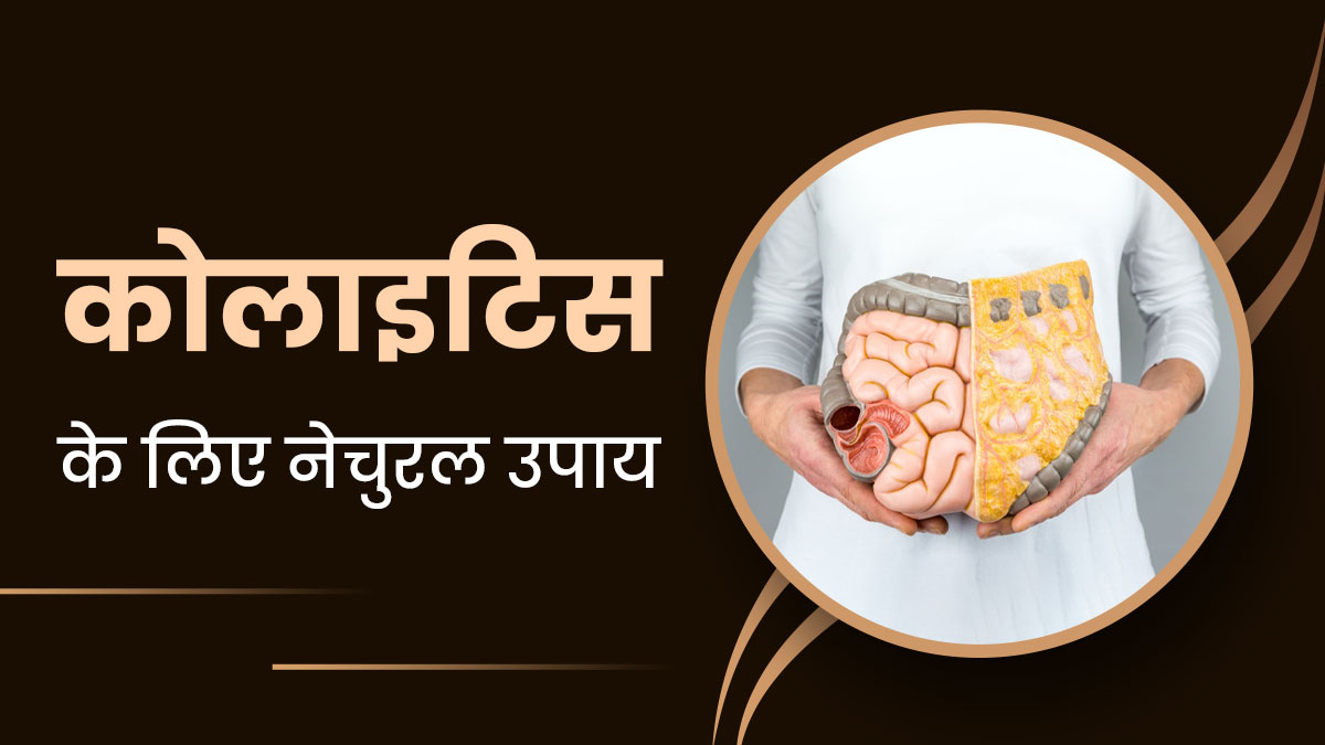 Colitis: कोलाइटिस (आंतों का रोग) होने पर अपनाएं ये 5 नेचुरल उपाय, दर्द और सूजन से मिलेगी राहत 